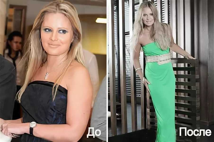 Дана борисова до и после пластических операций на лице и груди
