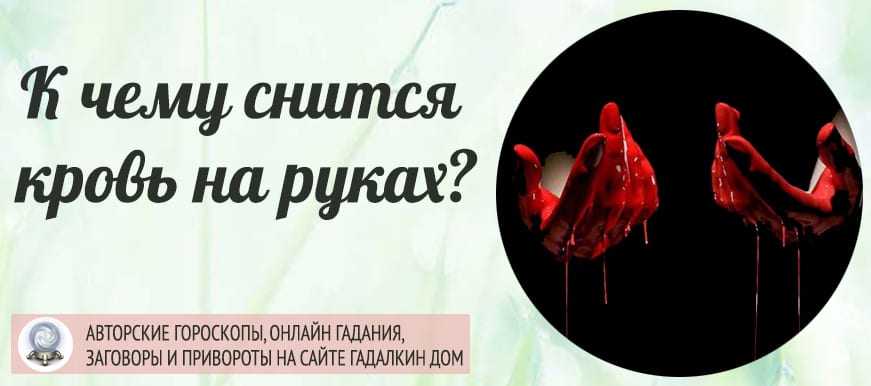 К чему снятся родинки на руках - толкование снов