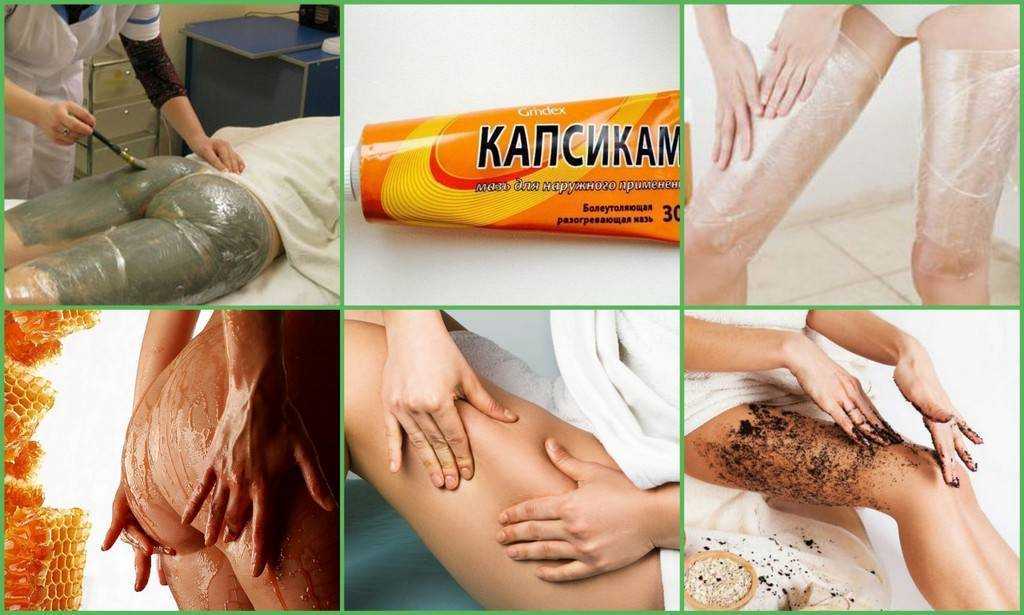 Как избавиться от целлюлита за пару недель? советы косметологов.