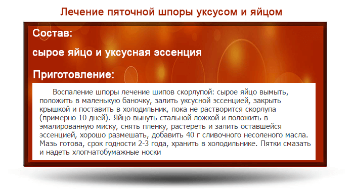 Пяточная шпора