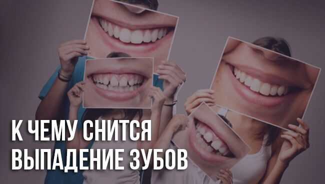 К чему снятся черви