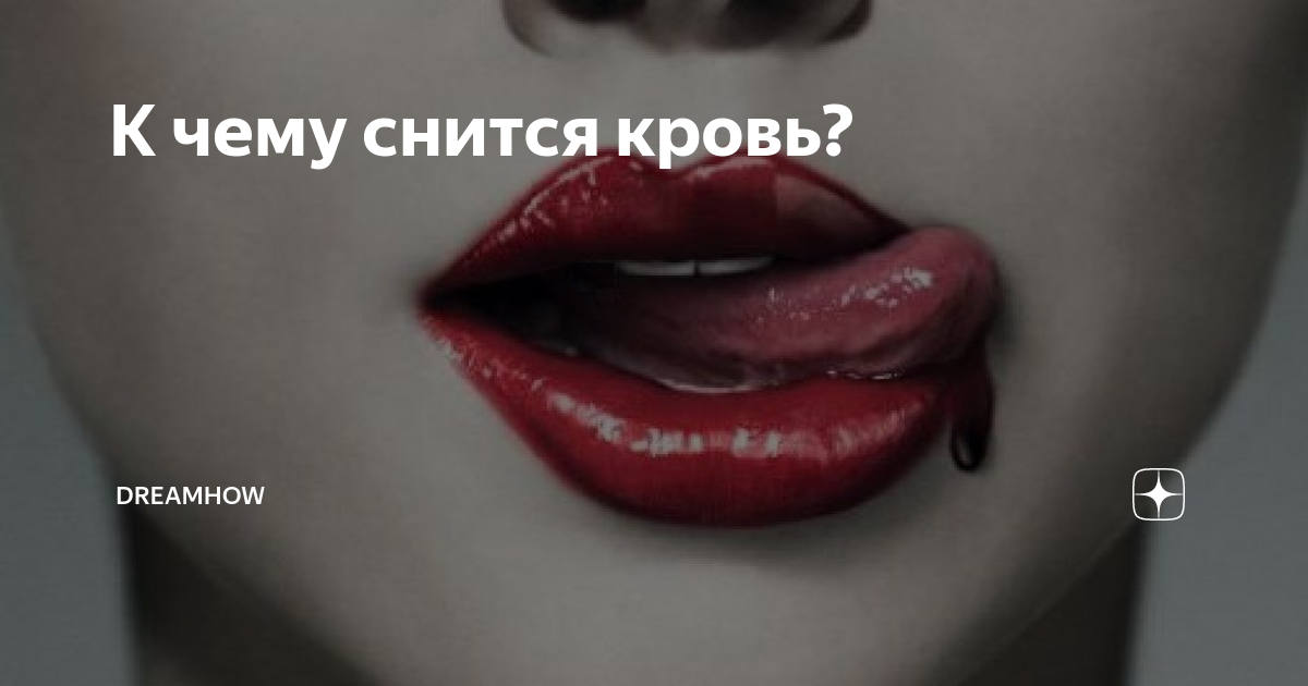 К чему снится кровь