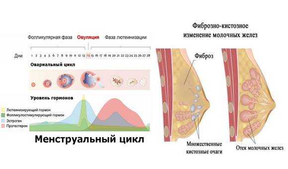 Почему может болеть грудь у женщины