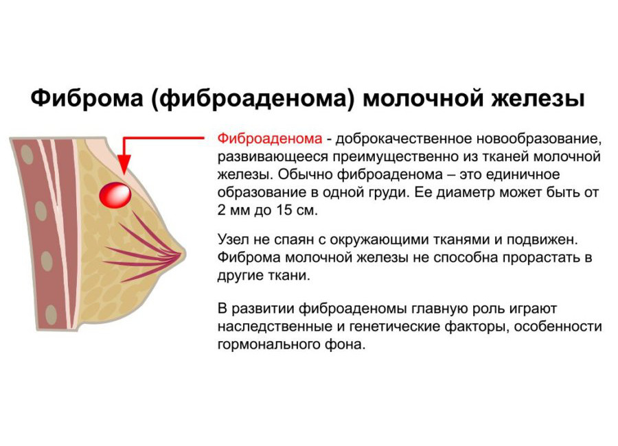 Выделения из сосков