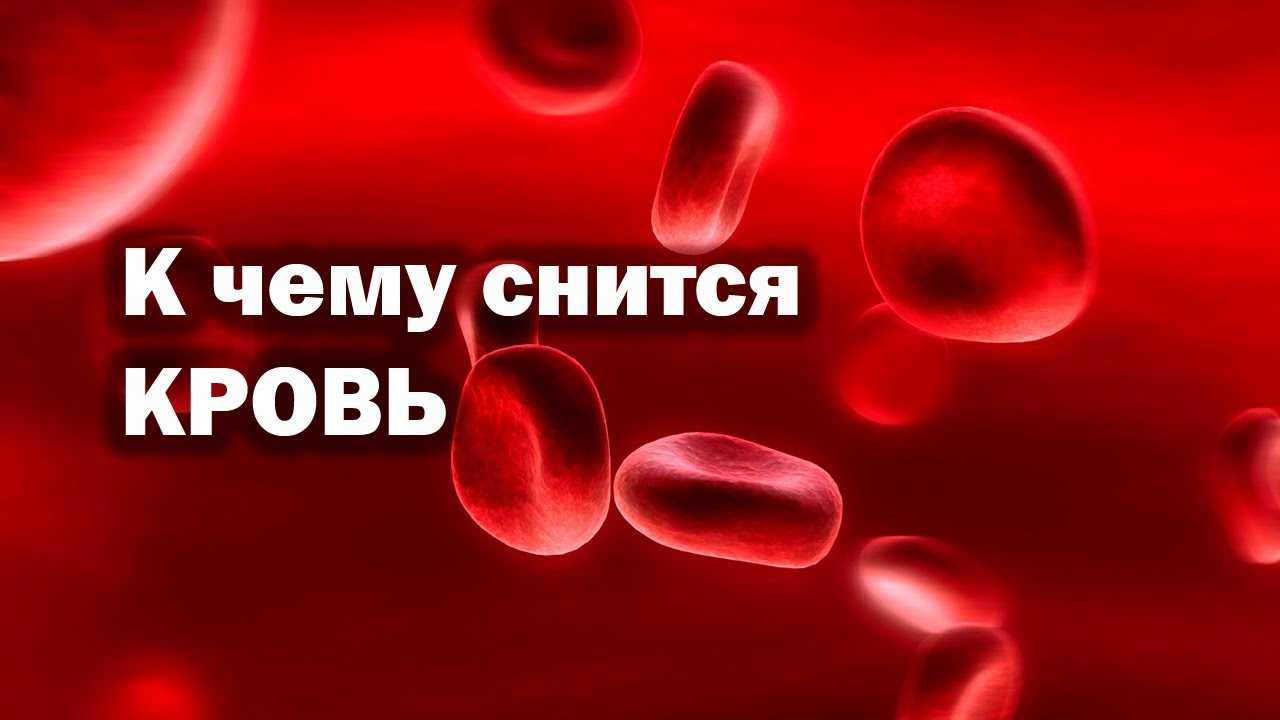 К чему снятся родинки: сонник, толкование сна для женщин и мужчин
